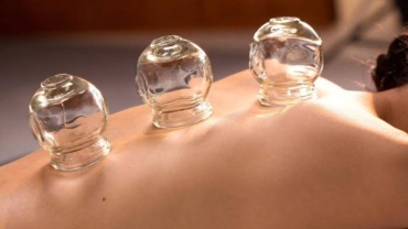 Cupping therapy treatment at Lenox Hill Massage